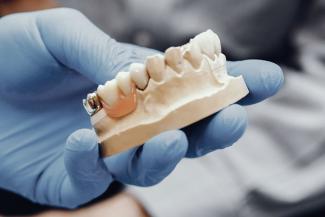 Prosthodontics | Alfonso Dental Clinic